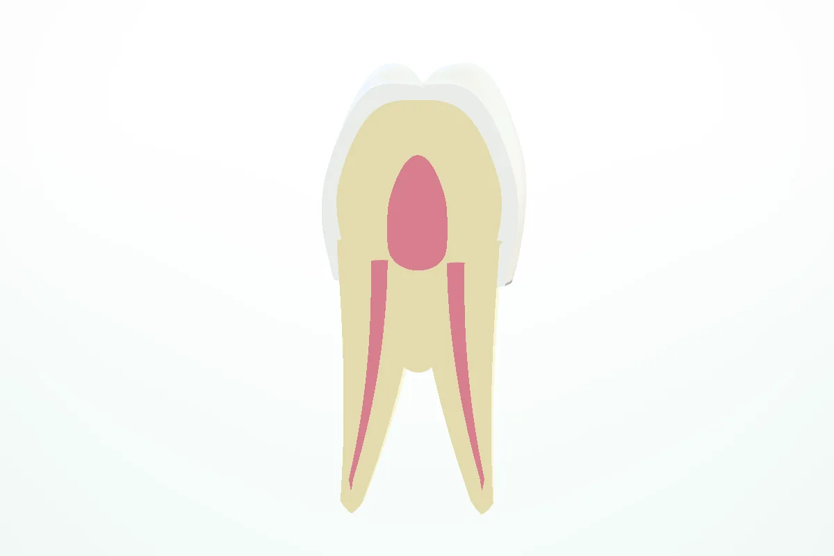 A molar cut cleanly in half, showing the enamel, dentine and pulp